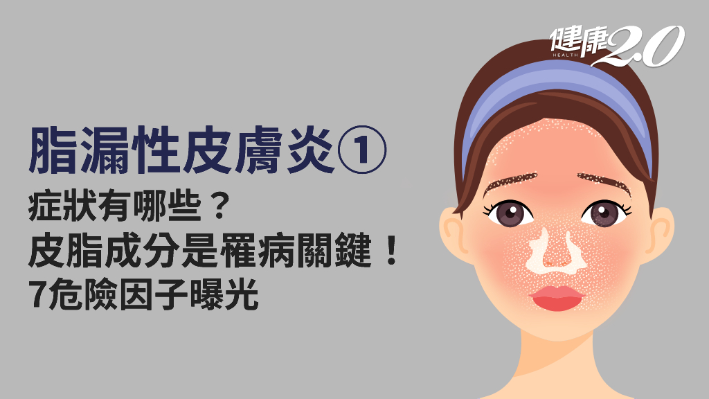 脂漏性皮膚炎／皮脂成分是致病關鍵！7大危險因子曝光 熬夜、壓力大都會誘發