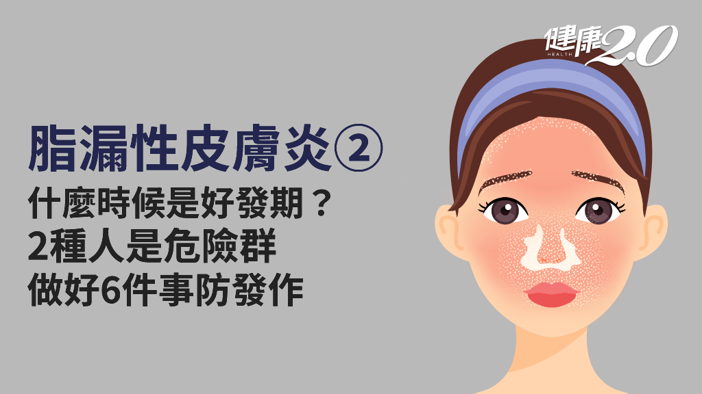 脂漏性皮膚炎／哪些人是好發群？誘發因子有哪些？預防發作1類食物千萬別吃