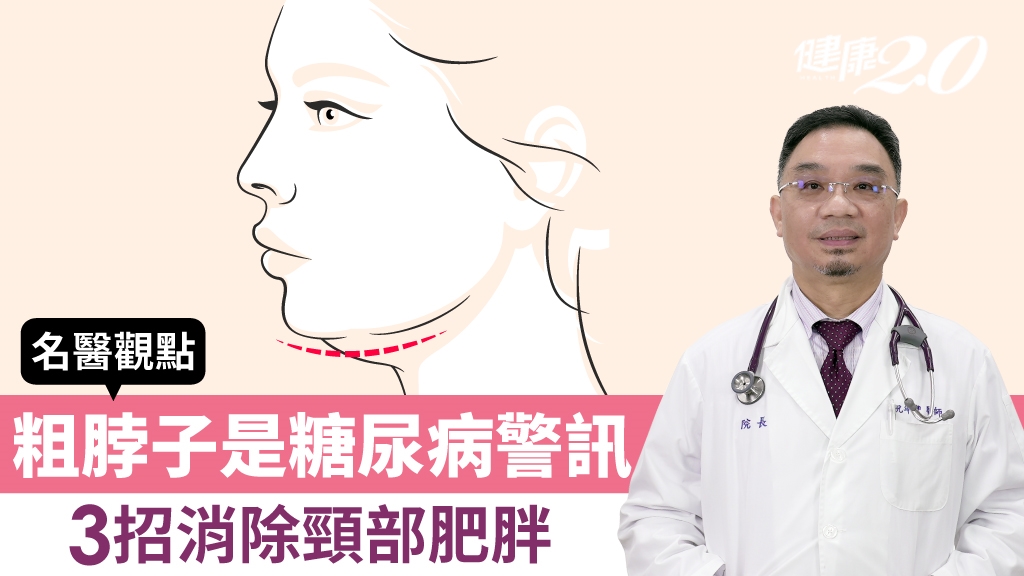 粗脖子是糖尿病、心臟病警訊！頸圍超過16、17吋當心了 名醫授3招消除頸部肥胖