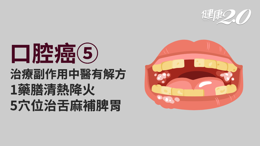 口腔癌／中醫緩解口腔黏膜發炎 穴位治療舌肌麻痺 1藥膳清熱降火
