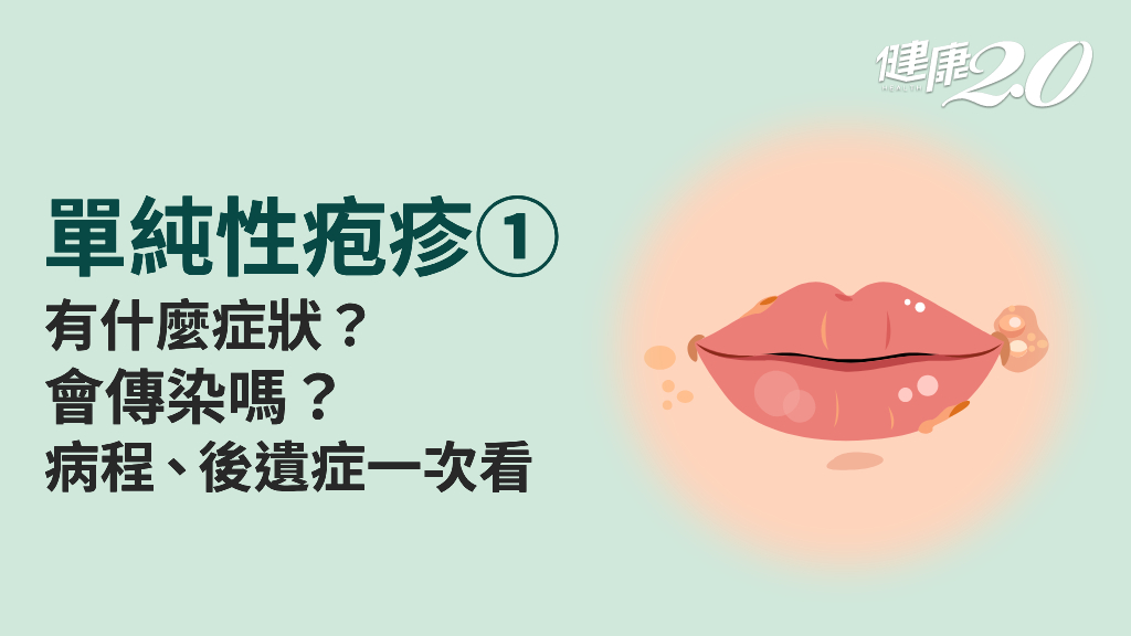 <span style="color:#1BA42B;">單純性疱疹</span>／是火氣大還是感染？<span style="color:#1BA42B;">單純性疱疹</span>是性病嗎？5種人感染小心失明或死亡