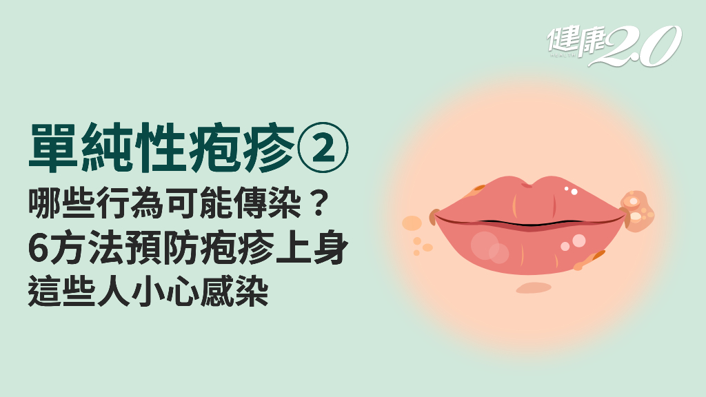 <span style="color:#1BA42B;">單純性疱疹</span>／共用毛巾、杯子就會傳染！該怎麼預防？哪些人是高危險群？