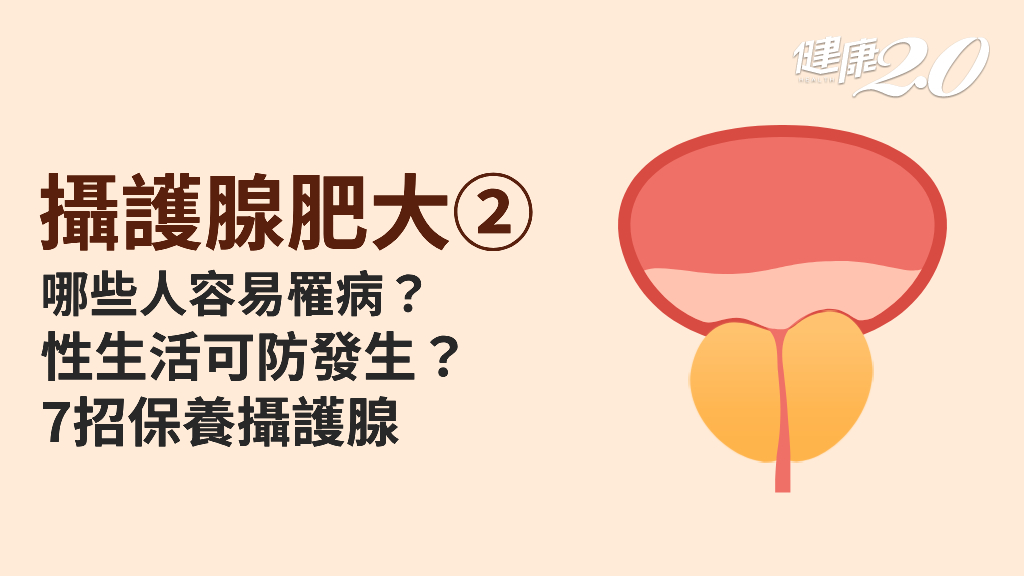 攝護腺肥大／病因與機轉有哪些？危險族群大揭曉！保養攝護腺做好7件事