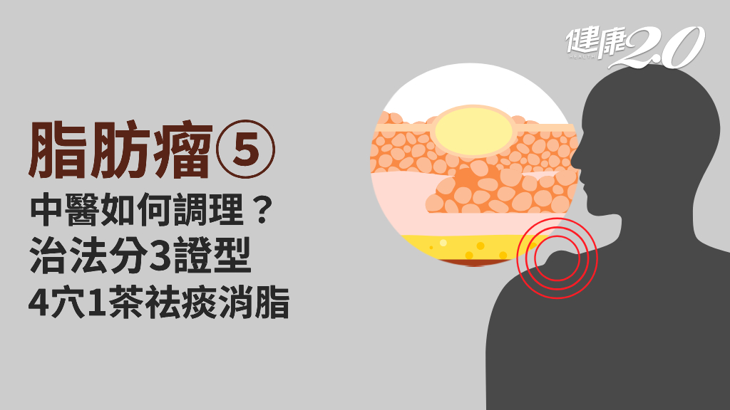 脂肪瘤／中醫如何治療脂肪瘤？4穴位化痰濕通經絡 1茶飲祛痰消脂幫助代謝