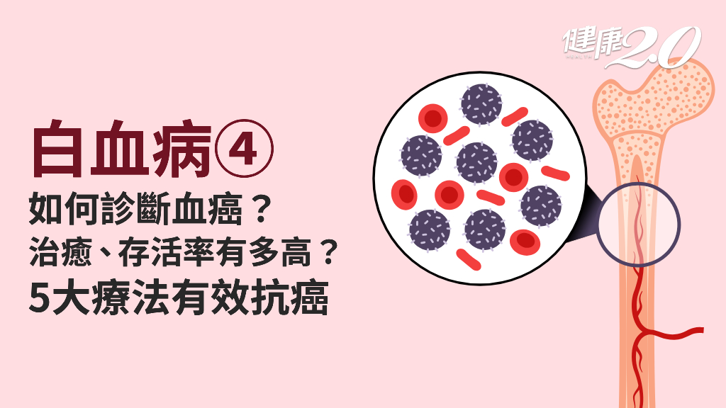 白血病／白血病是絕症嗎？骨髓穿刺、切片確定診斷 新型抗癌藥大幅提升治癒率
