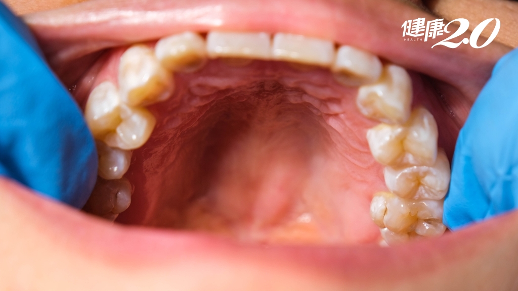 Search result thumbnail