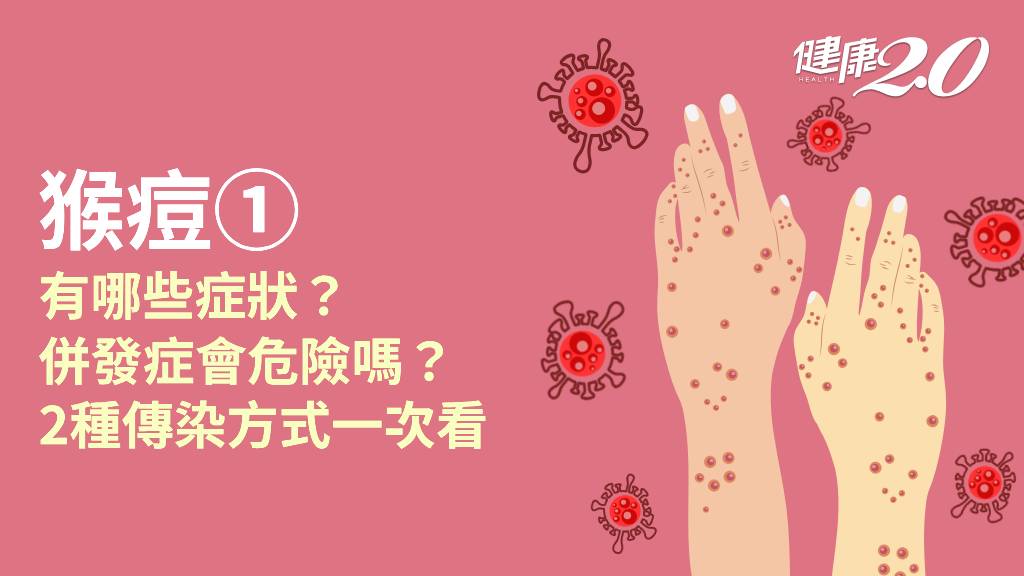 猴痘／猴痘長怎樣？潛伏期有幾天？猴痘傳染途徑有哪些？