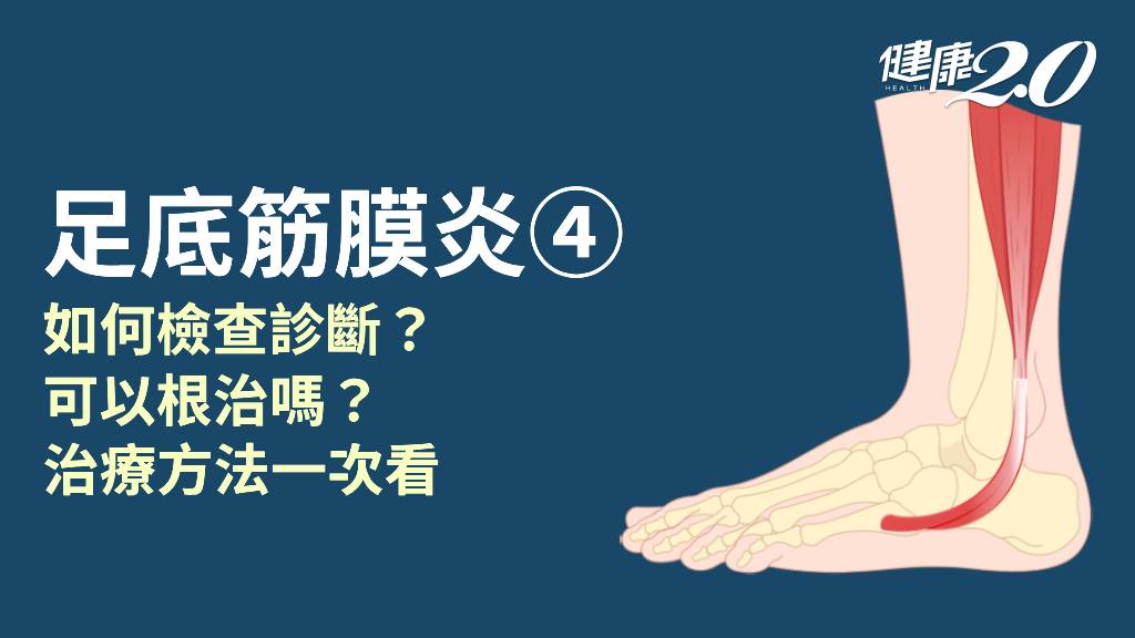足底筋膜炎／腳底「痛哪裡」才是足底筋膜炎？如何確診？治療方法有幾種？