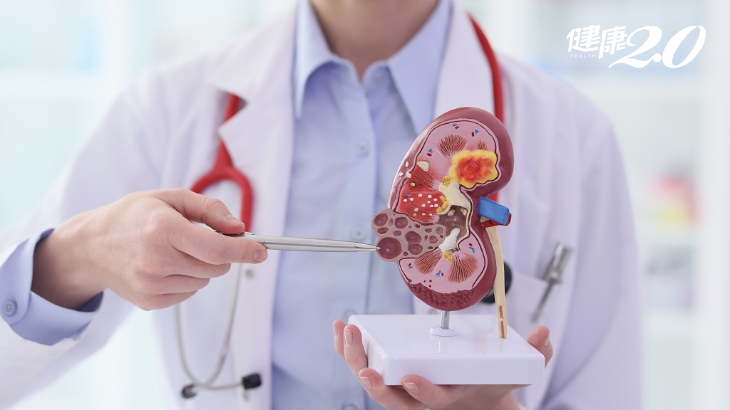 預防腎臟病就是愛護地球！建立8生活習慣 助你遠離洗腎人生