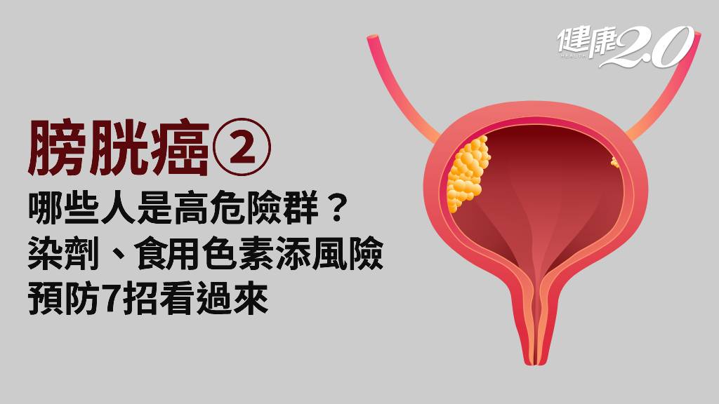 膀胱癌／哪些人是高危險群？染料工人風險增30倍！3大營養素防癌必備