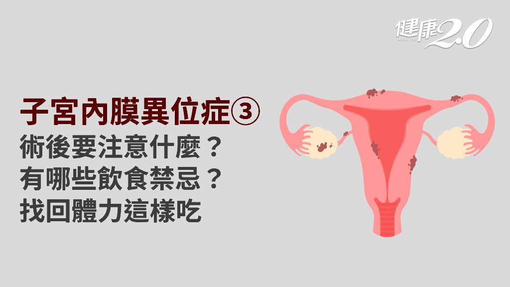 子宮內膜異位症／子宮內膜異位症可以根治嗎？患者飲食怎麼吃？1件事很重要