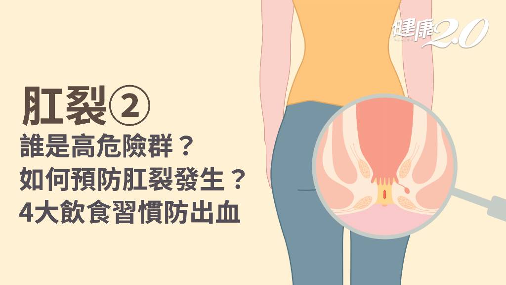 肛裂／5類人最容易中招 頭號元凶是它！4招遠離排便出血恐慌