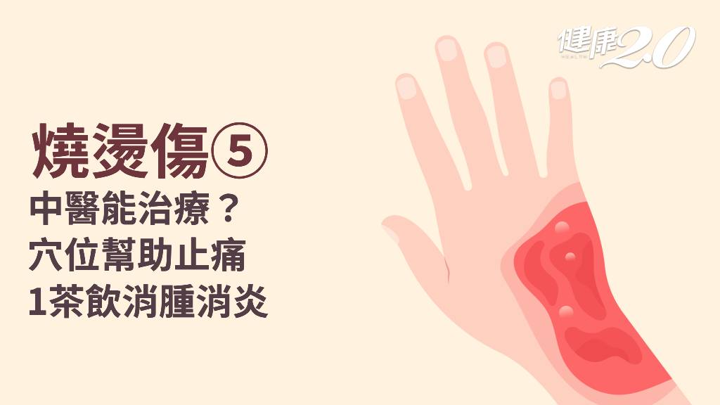 燒燙傷／中醫治療方法？疼痛怎麼改善？1茶飲加速傷口癒合