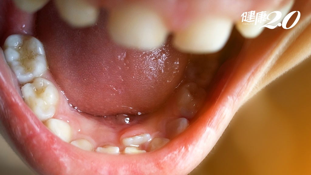 Search result thumbnail