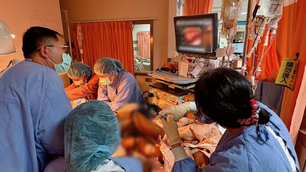 盲腸<span style="color:#1BA42B;">大出血</span>，大腸鏡遭血塊擋住過不去！醫護齊心「通腸止血」重症醫分享感人故事