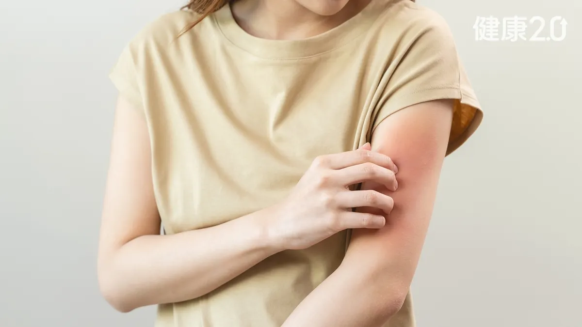 濕疹、異位性皮膚炎發作怎麼辦？6招止癢保養法超有效 這樣洗澡、擦乳液才對