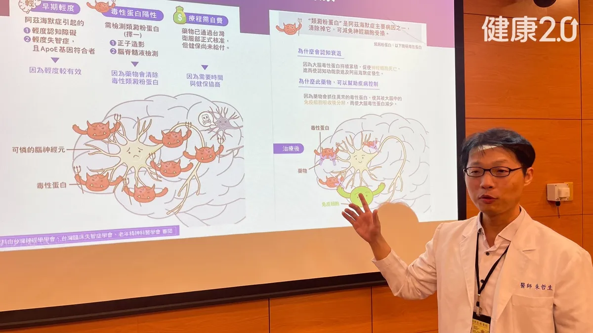 失智症「黃金2年」！症狀出現前15年就累積病變 新藥需測4指標