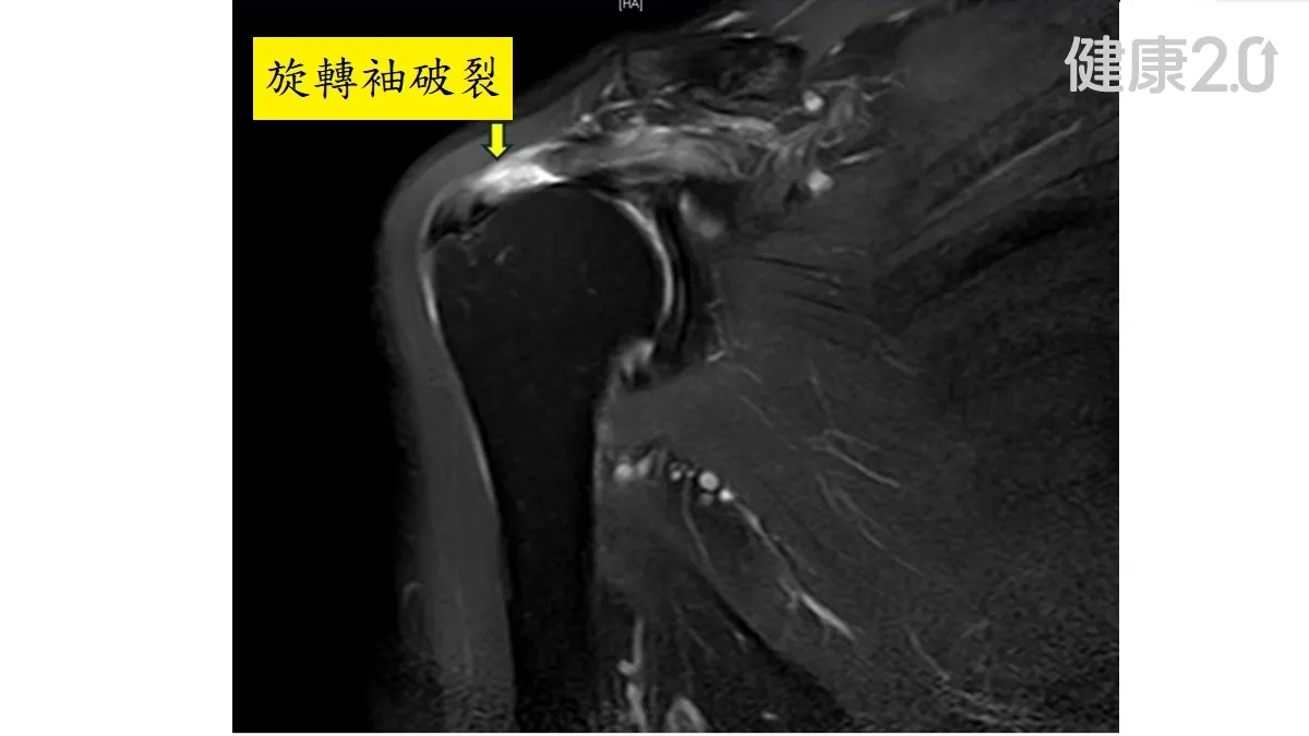 Search result thumbnail