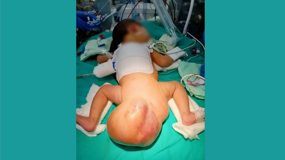 Search result thumbnail