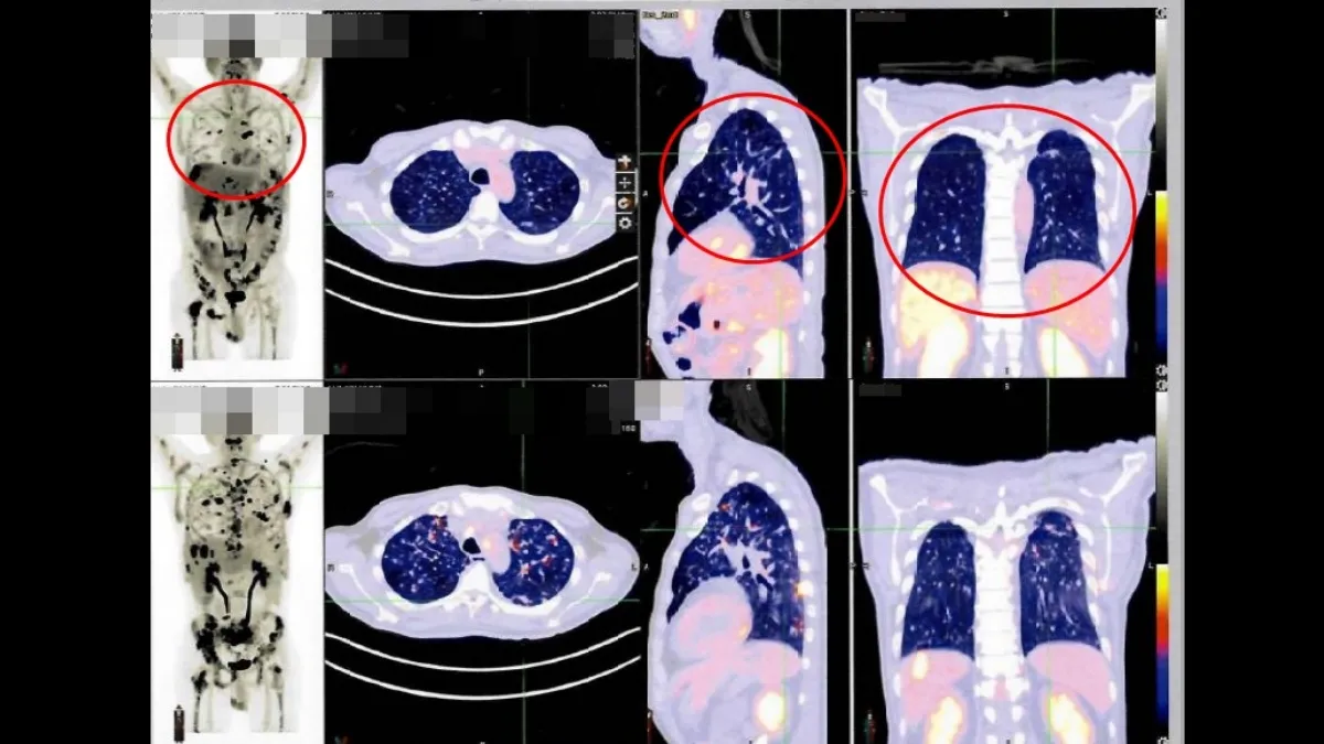 Search result thumbnail