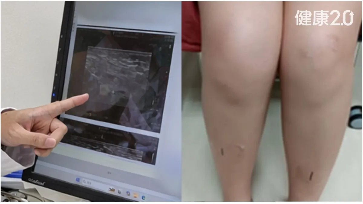 Search result thumbnail