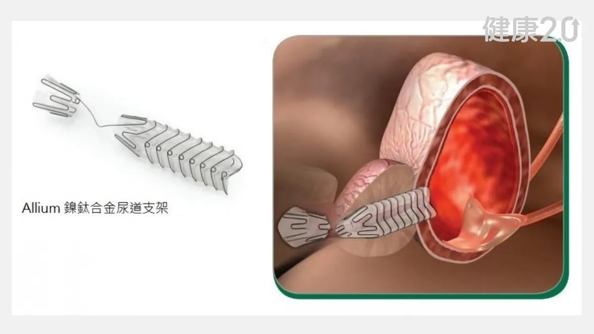 Search result thumbnail