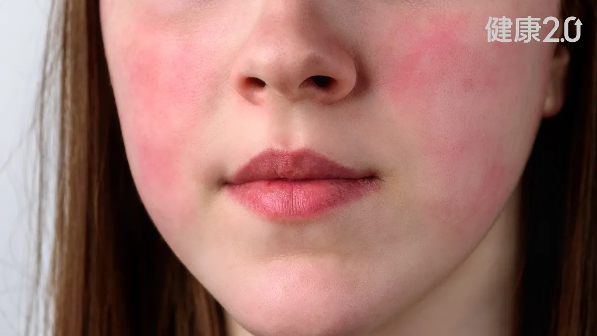 大叫一聲後猝死！女童疑染B19病毒 台大醫示警3族群須留意