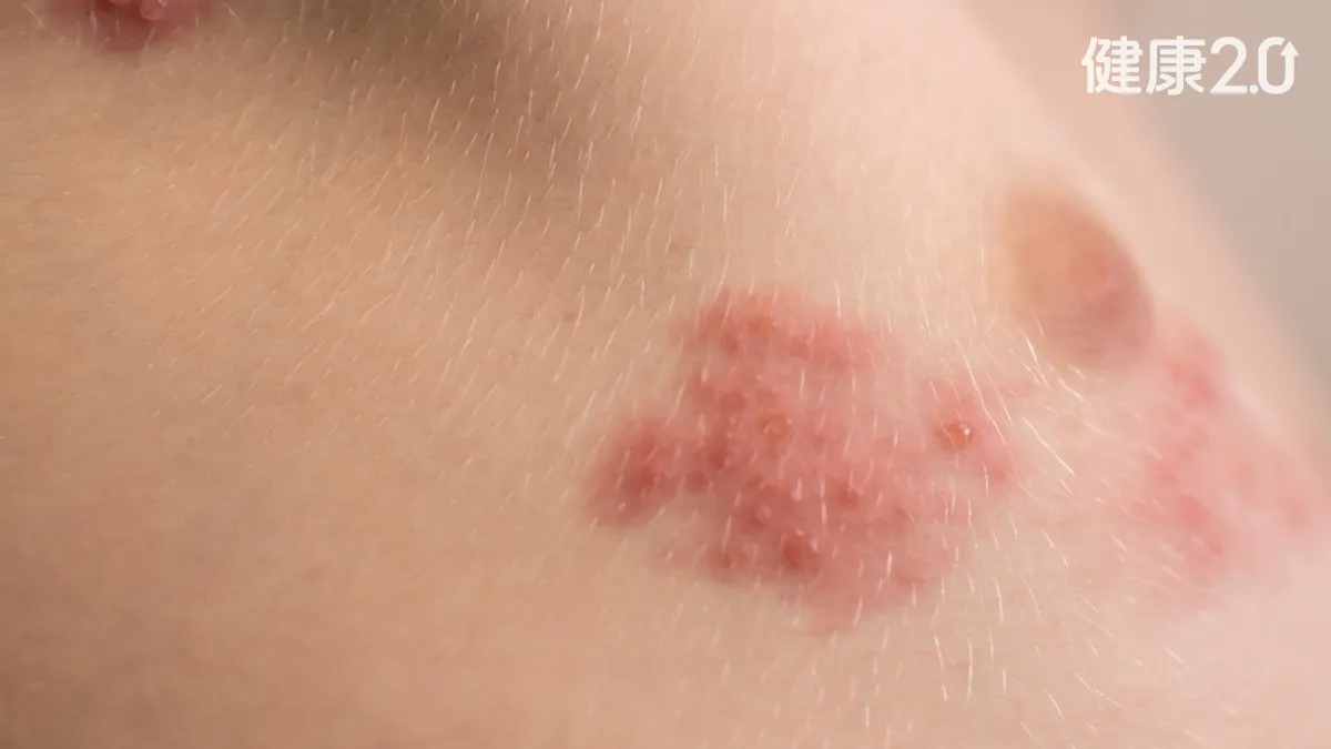 Search result thumbnail