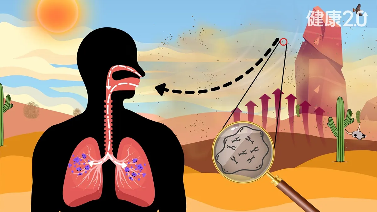 台人「球黴菌」感染3年暴增12倍！台大研究：多是半導體人/medical/360611