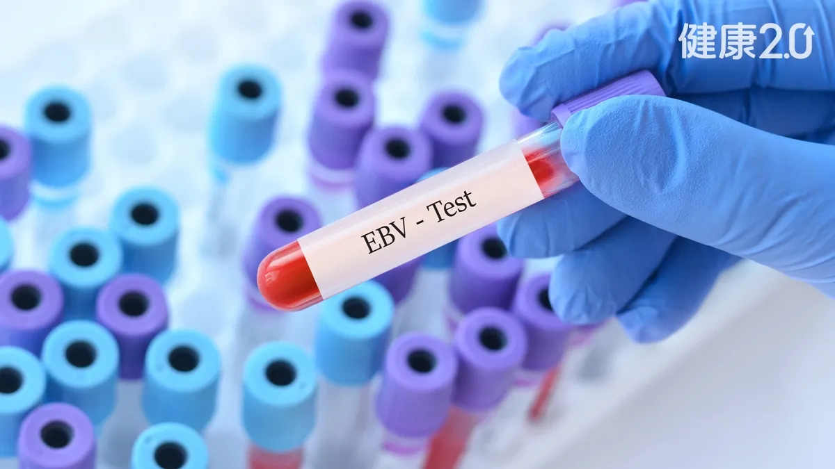 咖啡、綠茶降鼻咽癌風險！台大研究：4類食物助防癌 抽血能測抗體/cancer/360640