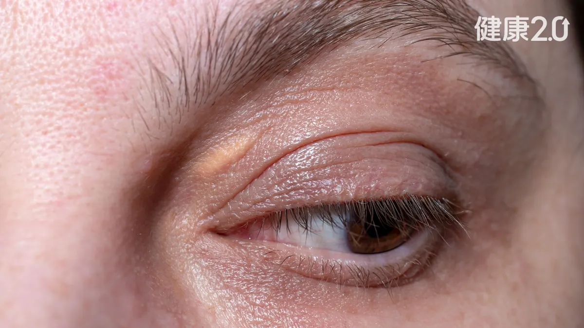 Search result thumbnail