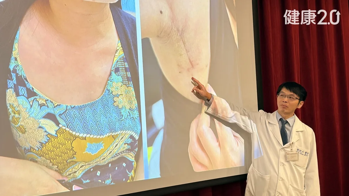 現省4萬元！甲狀腺手術新選擇 脖子無疤、聲音也顧到