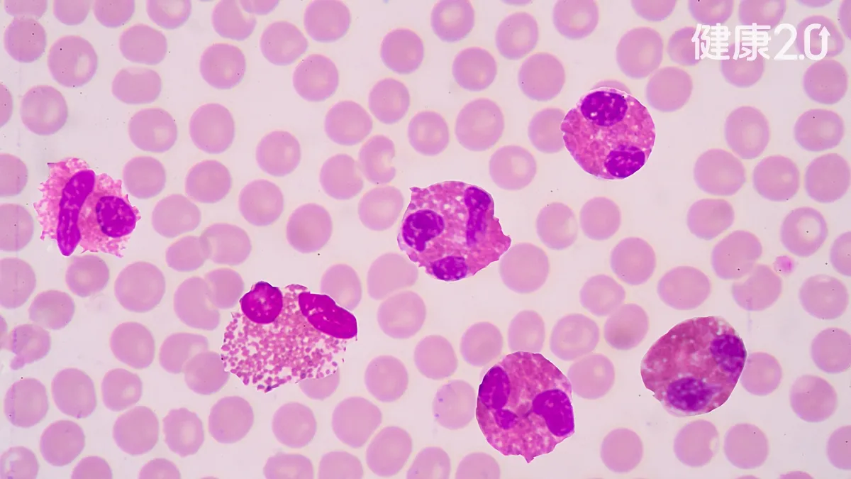 氣喘反覆發作不單純！手腳麻像觸電、起紅疹 抽血1指數恐免疫警訊