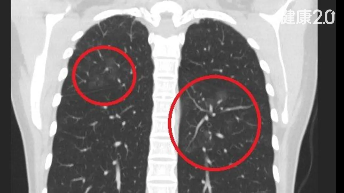 Search result thumbnail