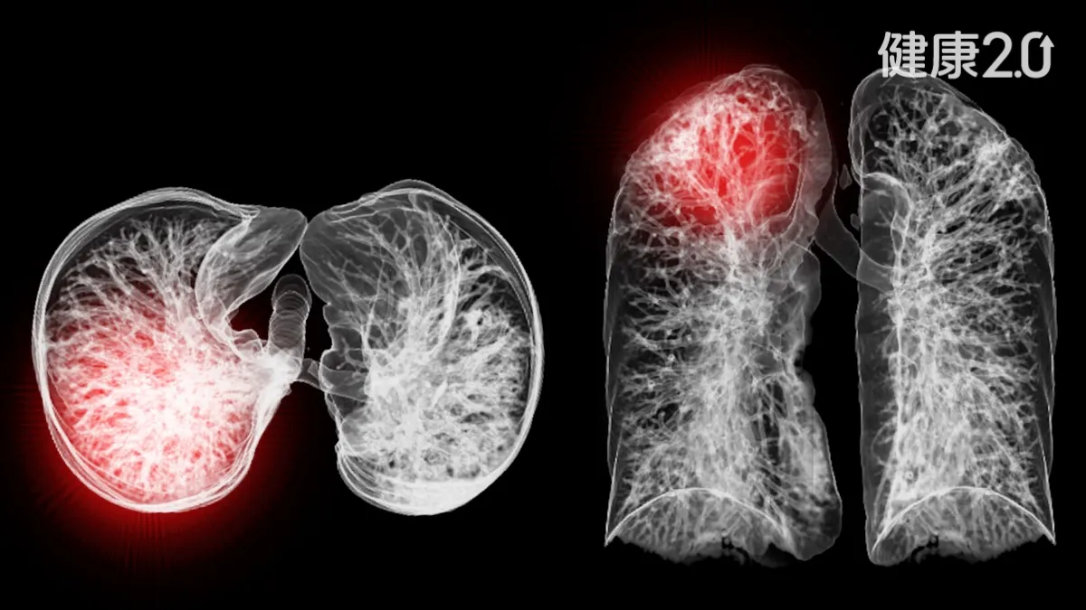 Search result thumbnail