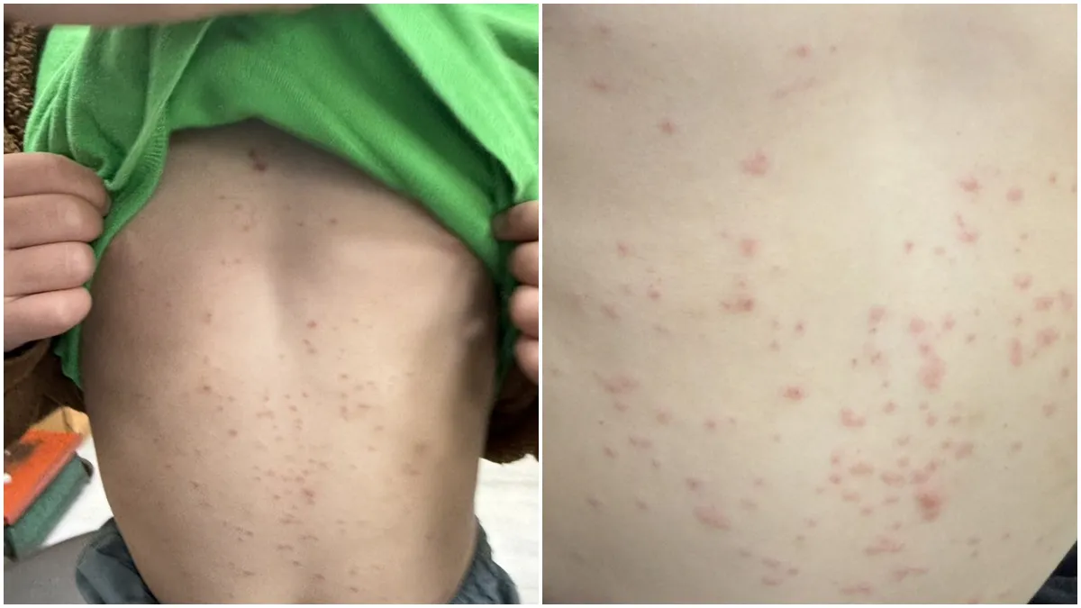 Search result thumbnail