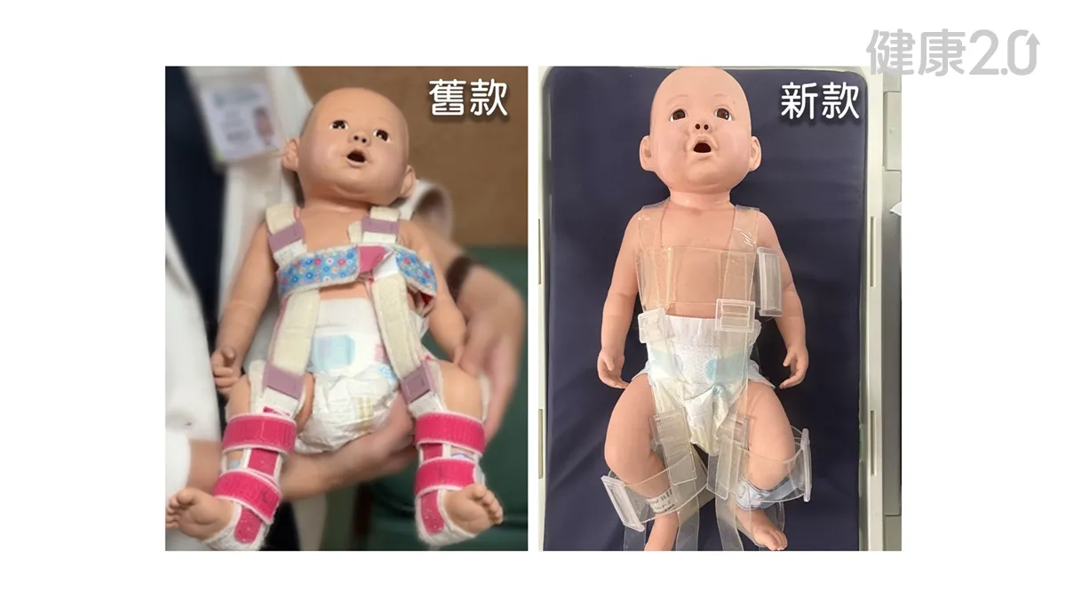 新生兒黃疸、髖關節治療可同步！彰基研發「透光型髖關節隱形矯具」