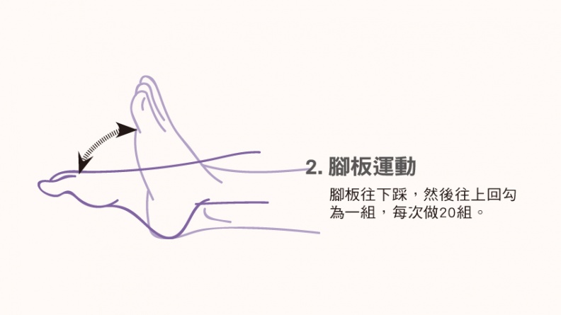 久站族必看！2招預防足底靜脈曲張/regimen/304708