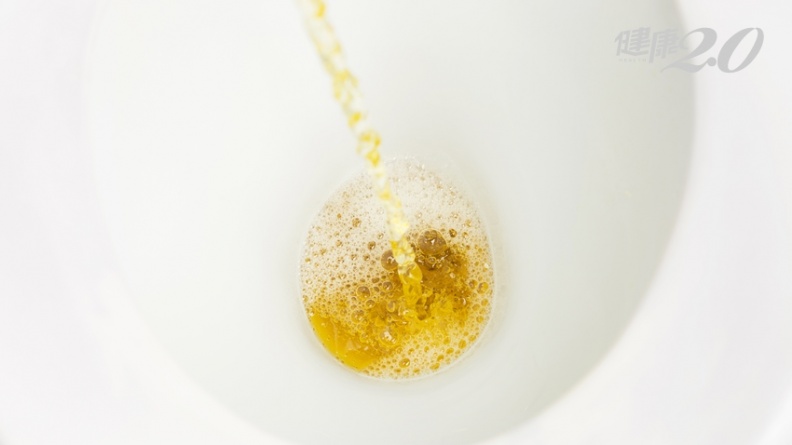 小便有泡泡、蛋白尿是腎臟出問題？5種身體狀況才是警訊