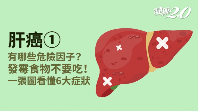 肝癌／「這種手掌」是肝癌警訊！肝癌有哪些前兆？必知6大症狀早救命