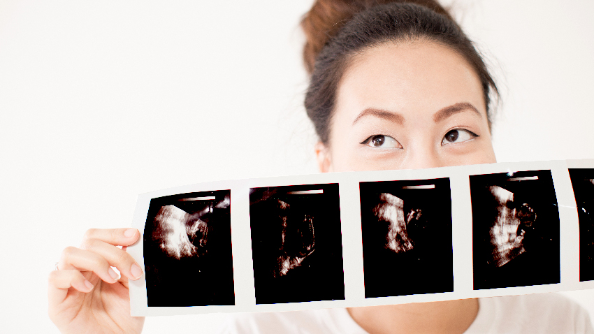 卵巢癌很難防 這５件事可以幫你