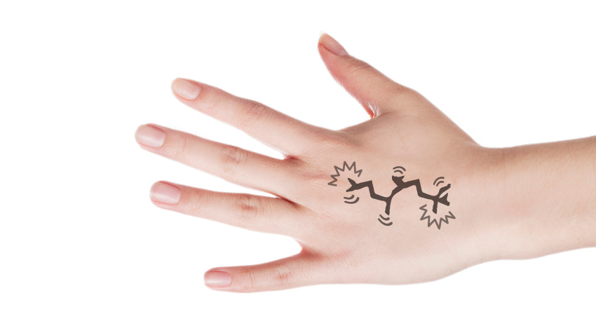 手背、小腿爆青筋，該看醫生嗎？