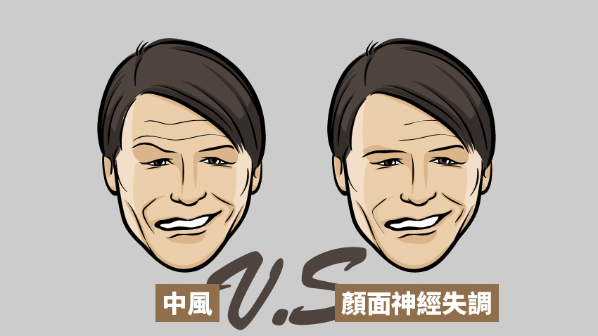 眼歪嘴斜是中風嗎？一條紋路就能判斷！