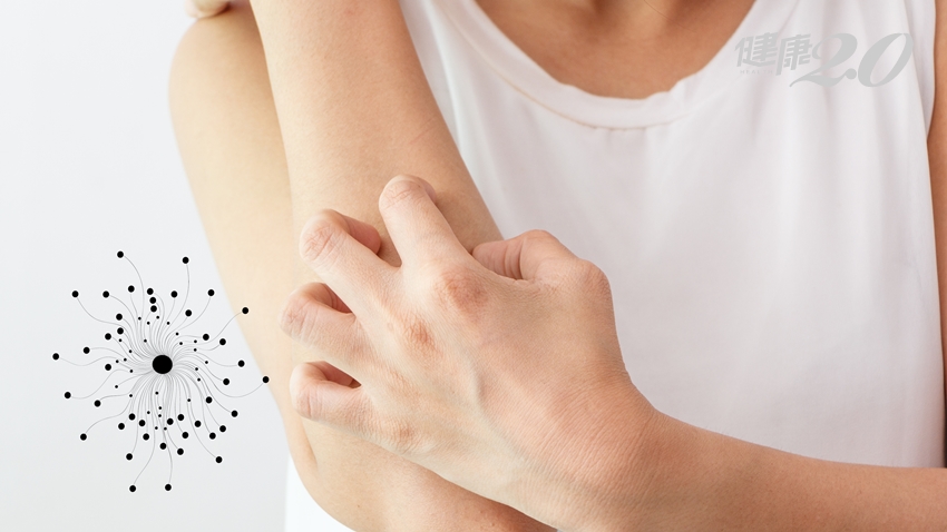 皮膚搔癢脫屑、腳癢、頭癢……原來是身體發霉了！/medical/310163