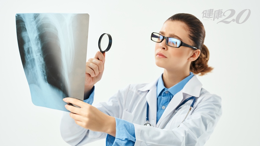 肺癌初期難發現 這7大症狀代表肺在求救/medical/310384