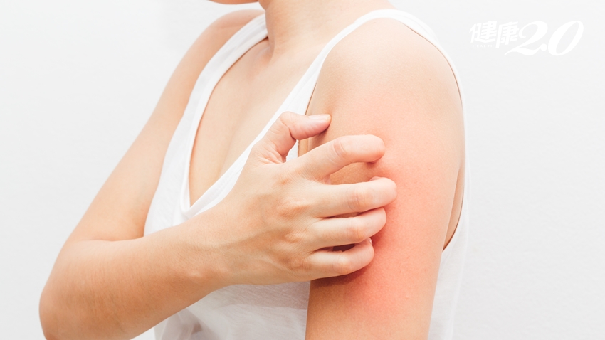 夏季皮膚癢？3種水果是禁區、4個生活法寶要備齊