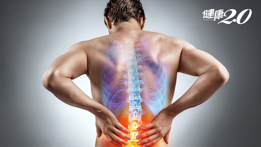 他身高180卻倒縮40公分！出現3狀況小心僵直<span style="color:#1BA42B;">性</span>脊椎炎