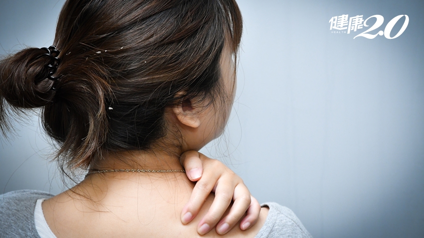 狂掉髮、頭皮屑掉滿地…全台近萬人被「乾癬」糾纏，治療緩慢陷瓶頸！