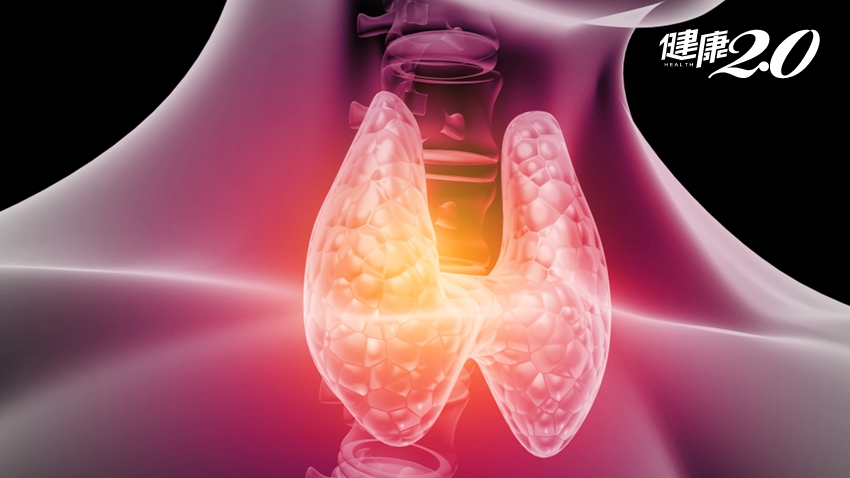 甲狀腺囊腫反覆出現？可以不開刀「酒精」治療！囊腫會變癌症嗎？