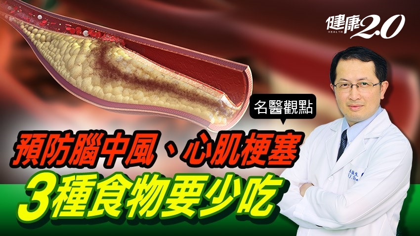心腦血管疾病比癌症奪命！預防腦中風、心肌梗塞 醫曝3種「壞膽固醇食物」要少吃